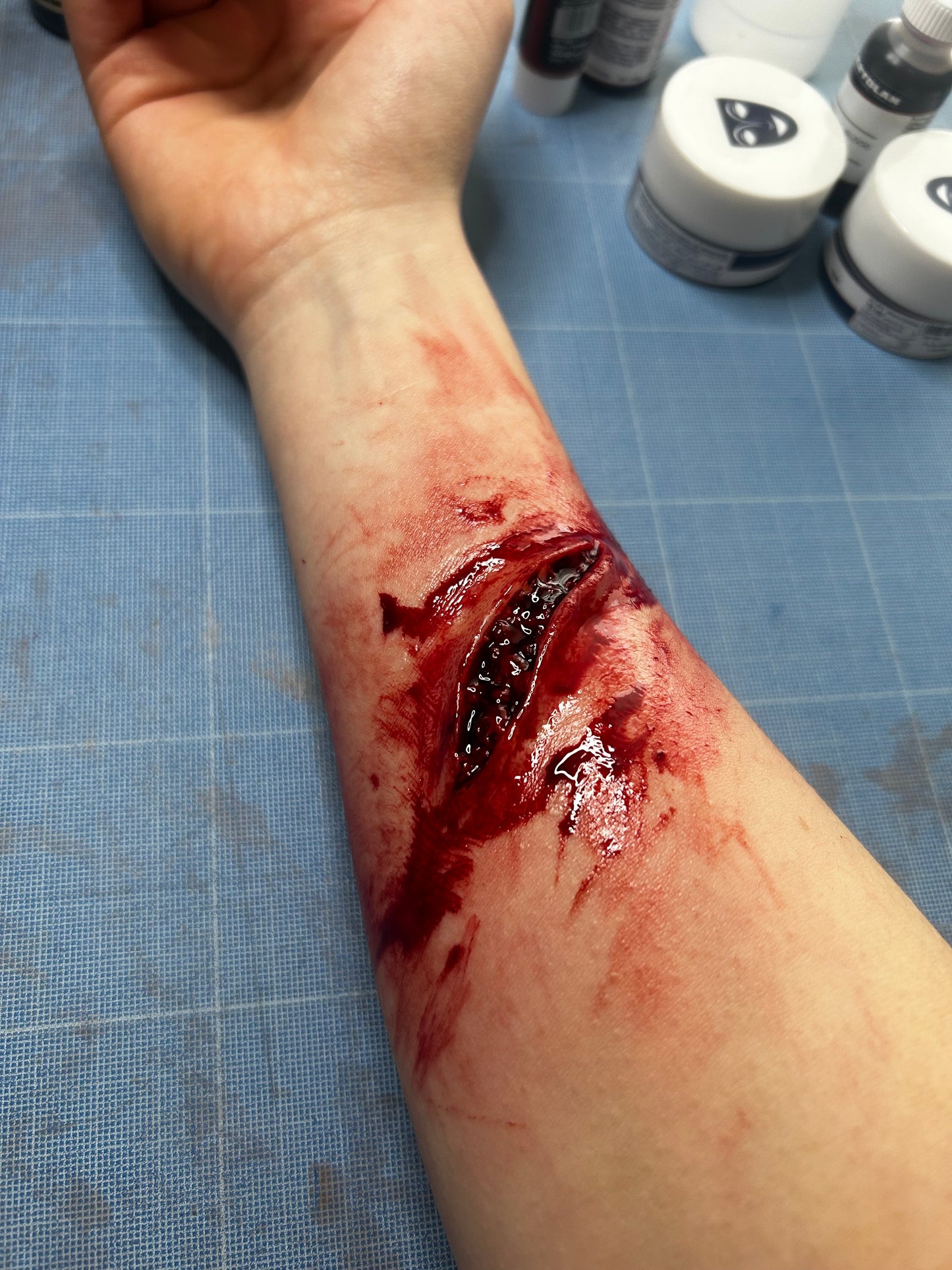 Plaie infectée #3