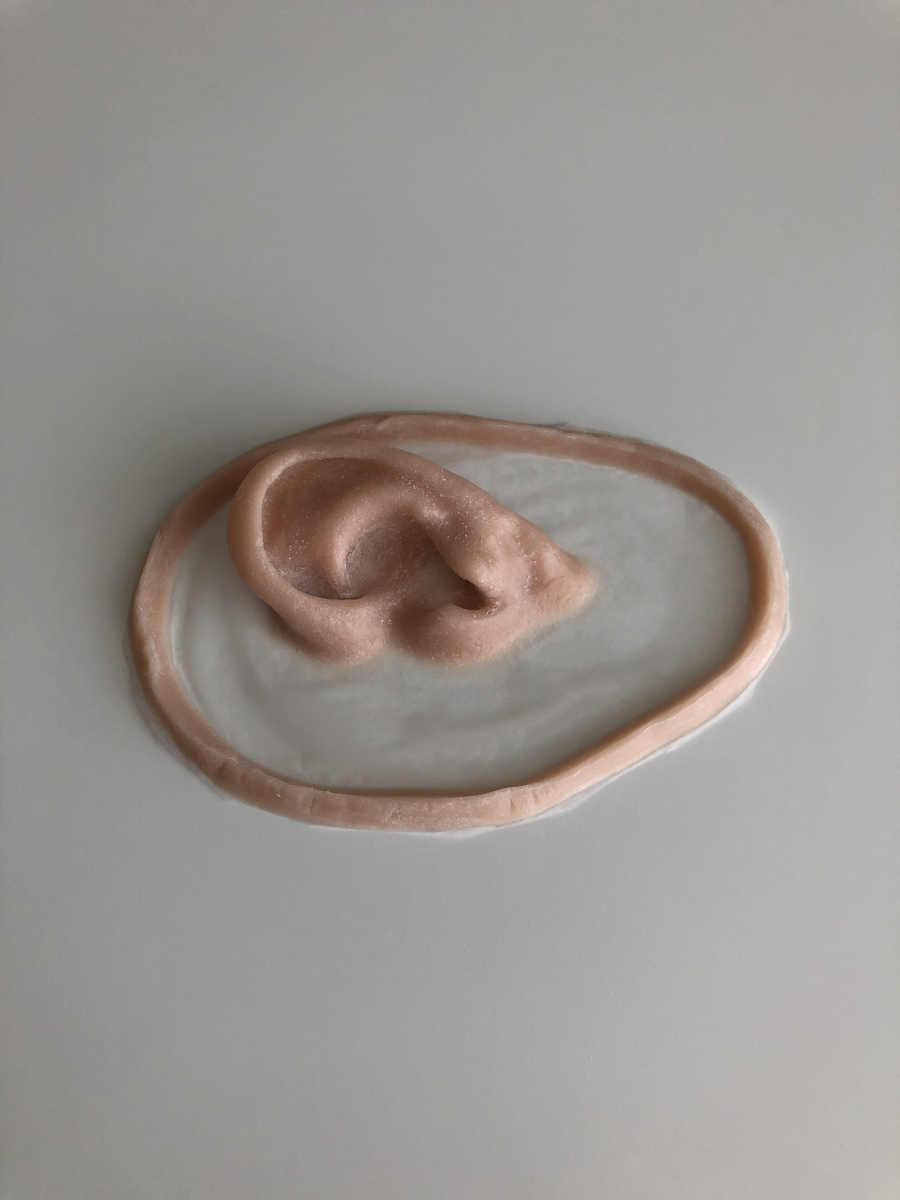 Prothèse d'oreille gauche