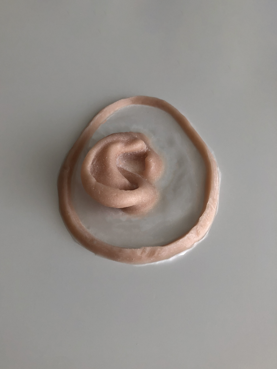 Prothèse d'oreille gauche